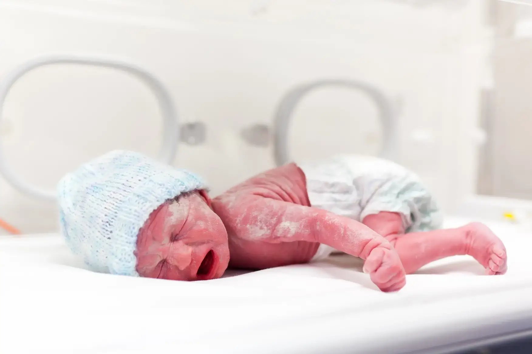 newborn-boy-covered-in-vertix-in-incubator-2024-12-03-14-19-07-utc