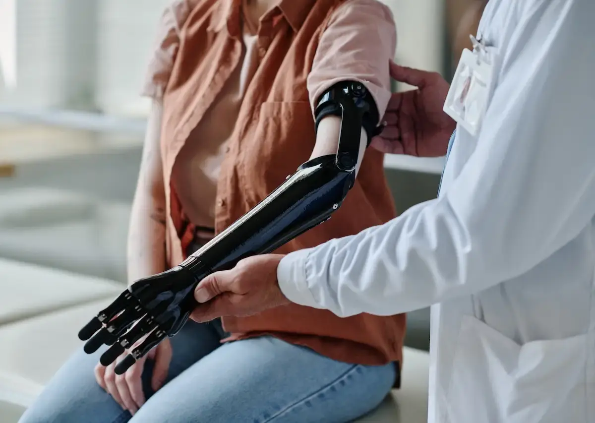close-up-of-doctor-fitting-mechanical-prosthetic-a-2025-03-08-17-08-00-utc