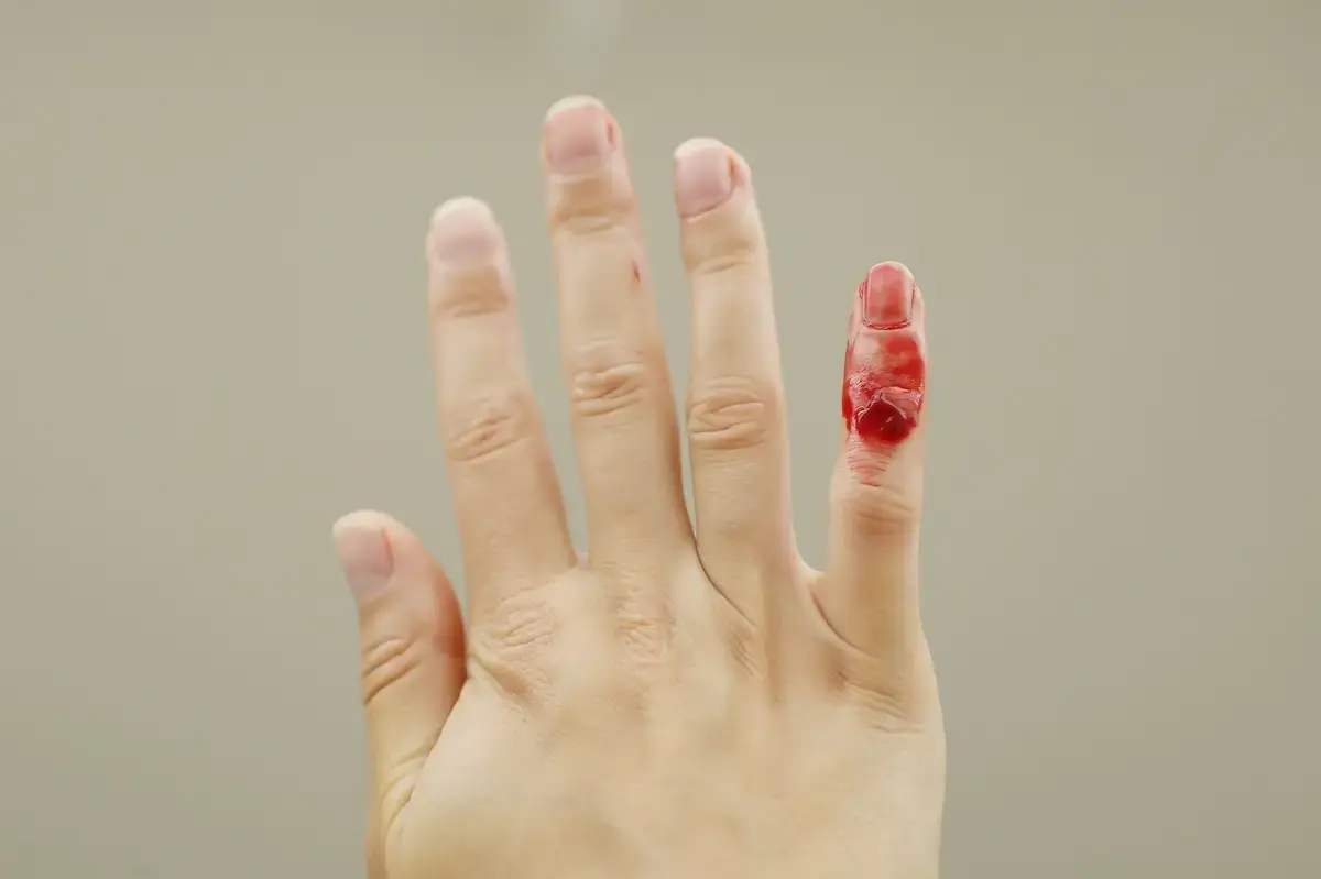 female-hand-with-red-blood-little-finger-is-bleed-2024-10-18-08-42-54-utc-1