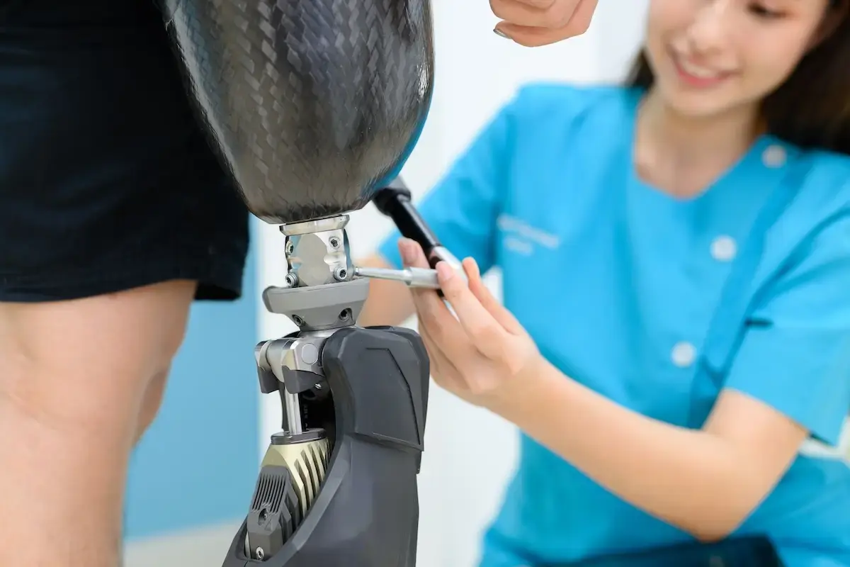 physiotherapist-adjusting-prosthetic-leg-of-patien-2024-10-11-00-07-45-utc