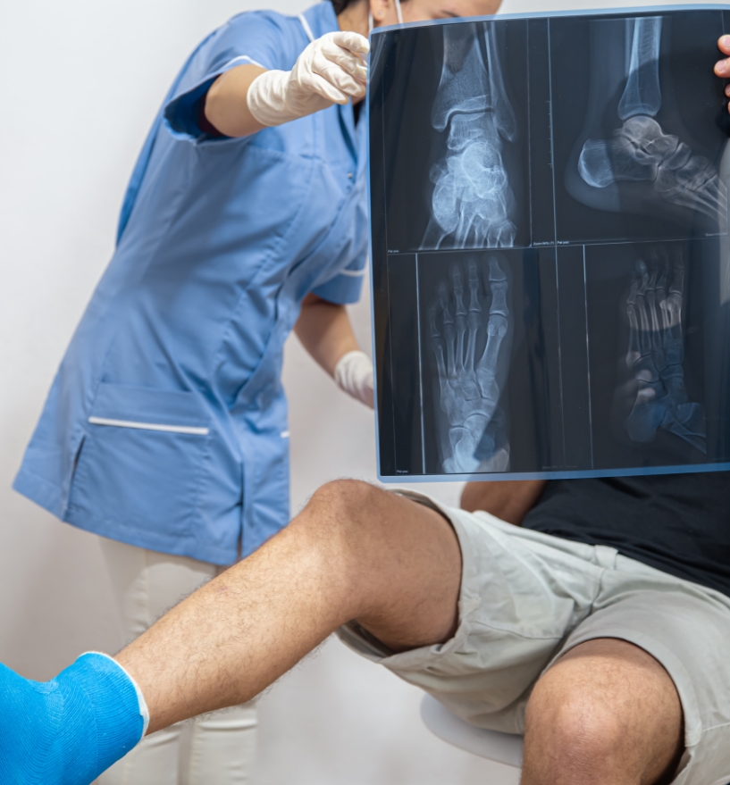 x-ray-of-a-foot-fracture-close-up-on-a-consultatio-2025-03-14-10-15-30-utc